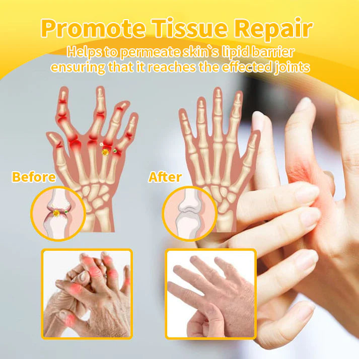 FATONGยฎ Bee Venom Pain-Relief Bone Healing Cream๐จโโ๏ธ (Suitable for all ages)๐จโโ๏ธ