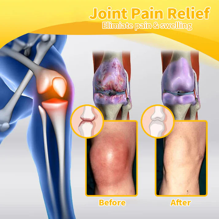 FATONGยฎ Bee Venom Pain-Relief Bone Healing Cream๐จโโ๏ธ (Suitable for all ages)๐จโโ๏ธ