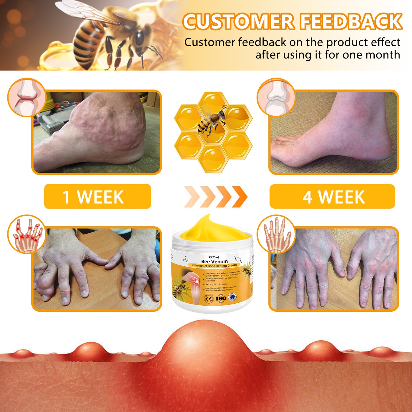 FATONGยฎ Bee Venom Pain-Relief Bone Healing Cream๐จโโ๏ธ (Suitable for all ages)๐จโโ๏ธ